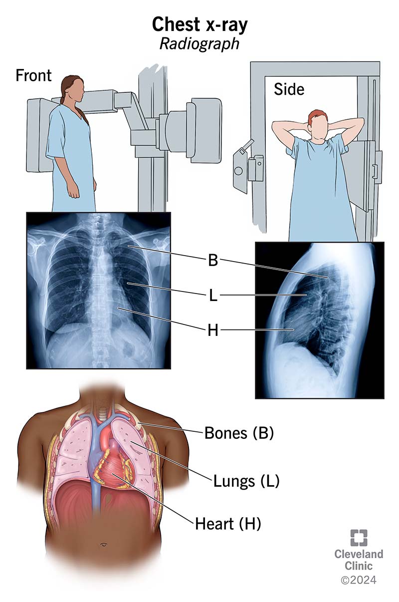 Viste frontali e laterali della radiografia del torace, che mostra ossa, polmoni e cuore.