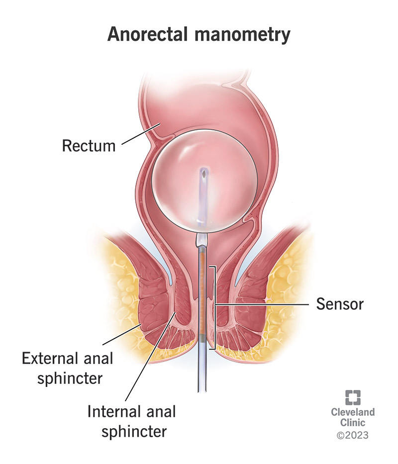 12760 anorectal manometry