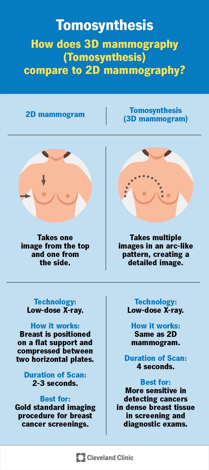 Confronto tra mammografia 2D e tomosintesi