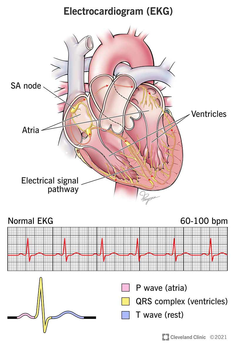 Illustrazione di come un ECG monitora l'attività elettrica del cuore.