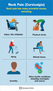 21179 neck pain cervicalgia