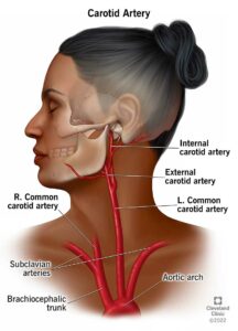 21492 carotid artery