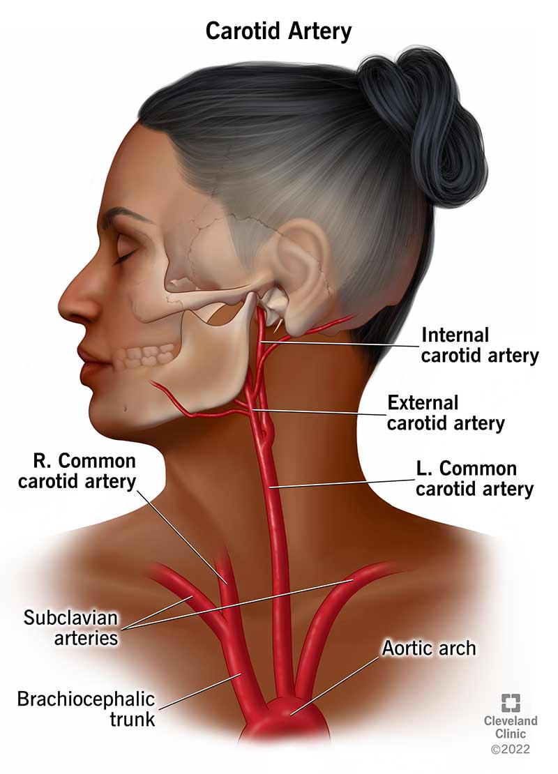 Illustrazione che mostra la posizione delle arterie carotidi.