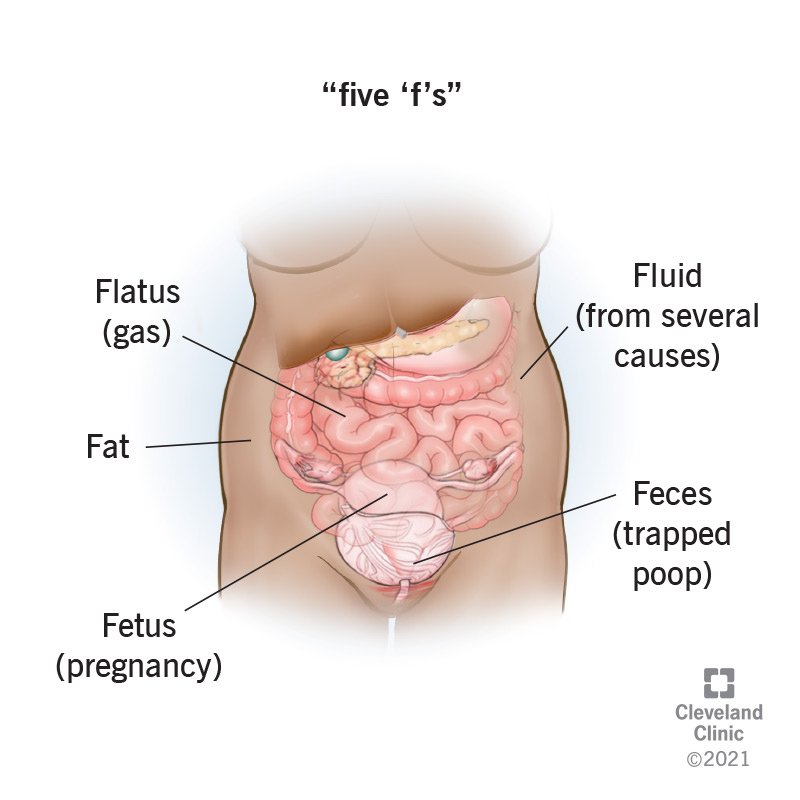 Le principali cause di distensione addominale generalizzata sono grasso, feci, feto, flatulenza e liquidi.