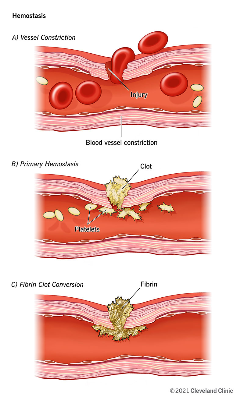 Durante l'emostasi, il tuo corpo tappa una ferita sanguinante e usa quel tappo come punto di partenza per riparare la lesione.