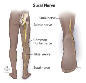 22323 sural nerve