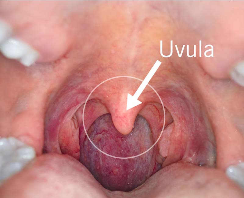 22674 uvula