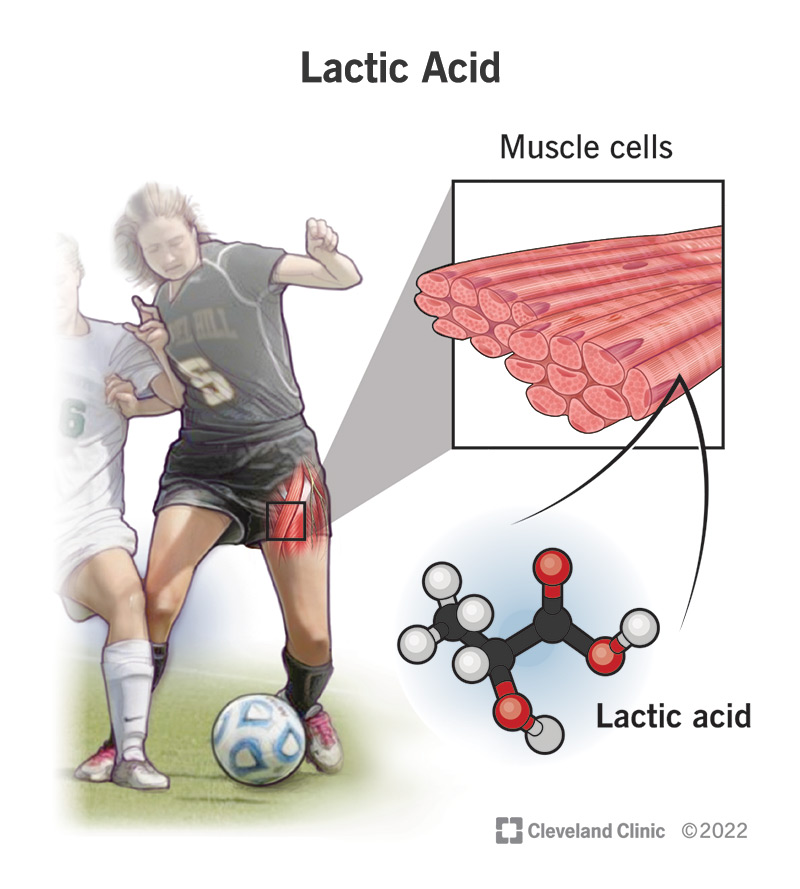 24521 lactic acid