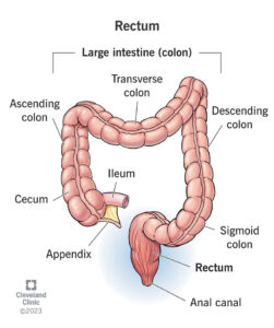 24785 rectum