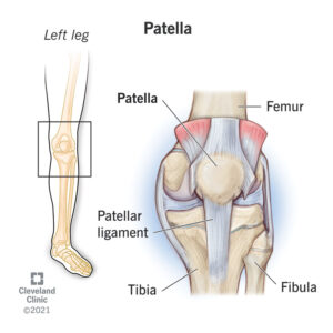 25038 patella