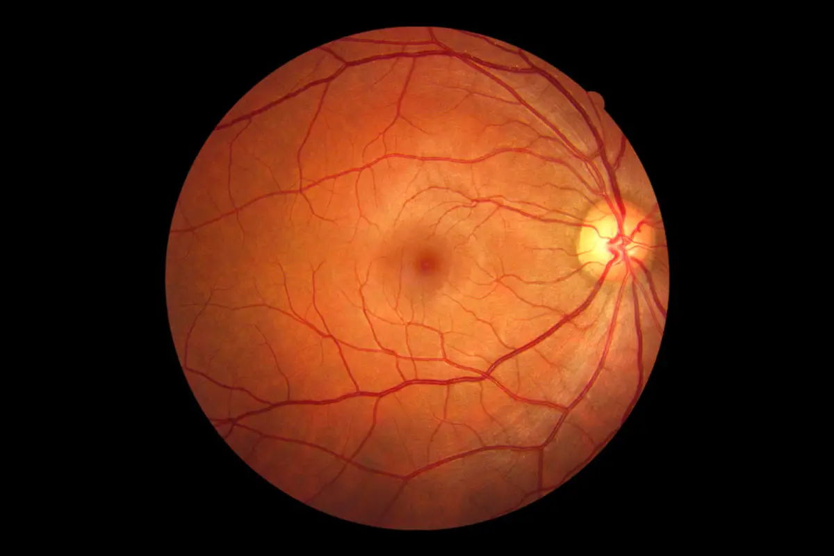 Un'immagine della parte posteriore dell'occhio che le tecnologie di imaging della retina possono produrre.