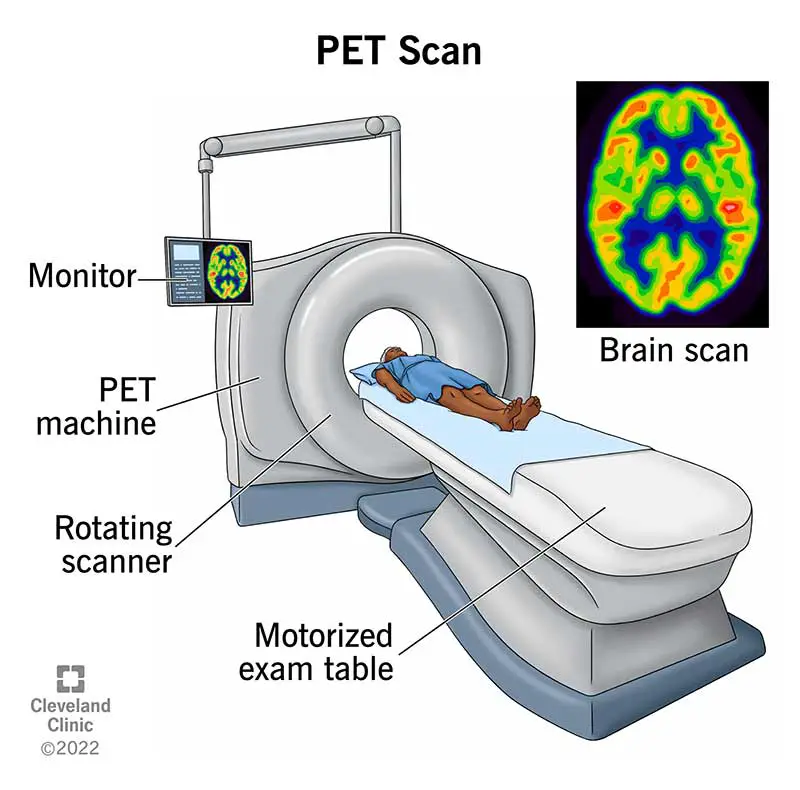 10123 pet scan