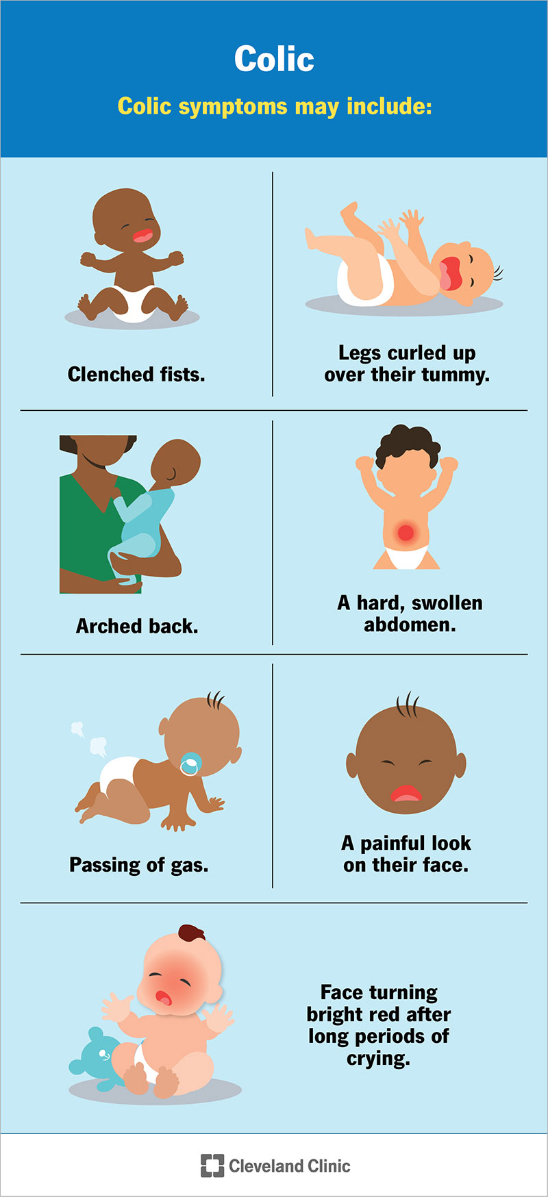 Se il tuo bambino ha le coliche, potrebbe presentare sintomi tra cui pugni chiusi, schiena inarcata e pancia dura e gonfia.