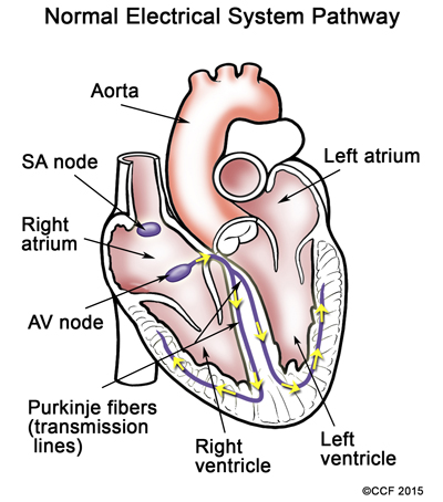Il normale percorso del sistema elettrico spinge il sangue attraverso il cuore e verso il resto del corpo.