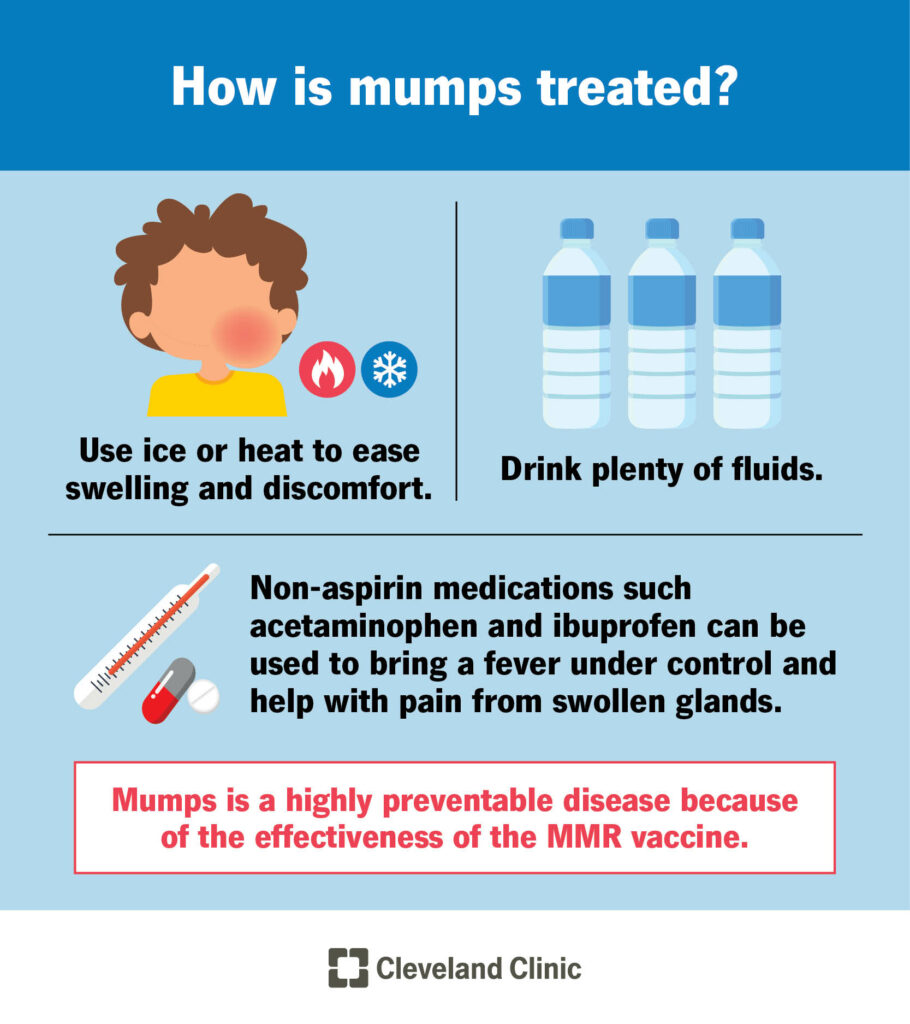 15007 mumps