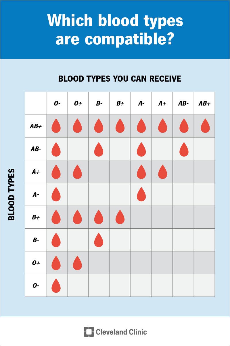 Un grafico che mostra quali gruppi sanguigni sono sicuri da ricevere per ciascun gruppo sanguigno