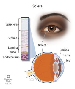 22088 sclera