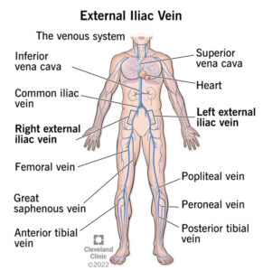 22542 external iliac vein