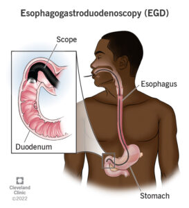 22549 esophagogastroduodenoscopy