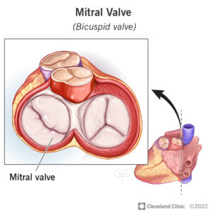 23244 mitral valve