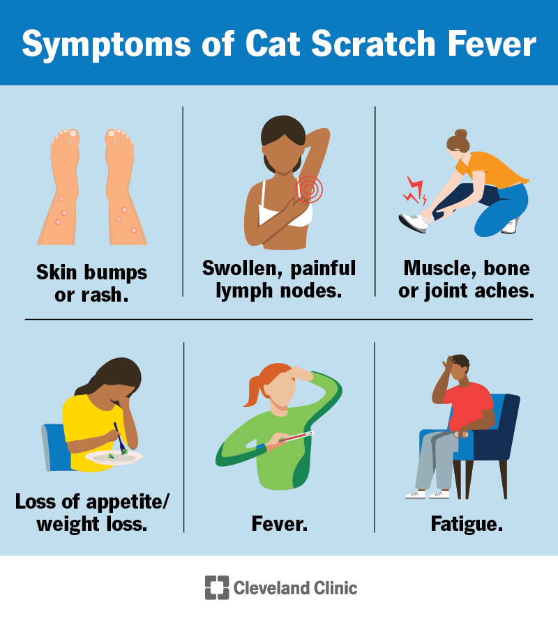 23537 cat scratch fever