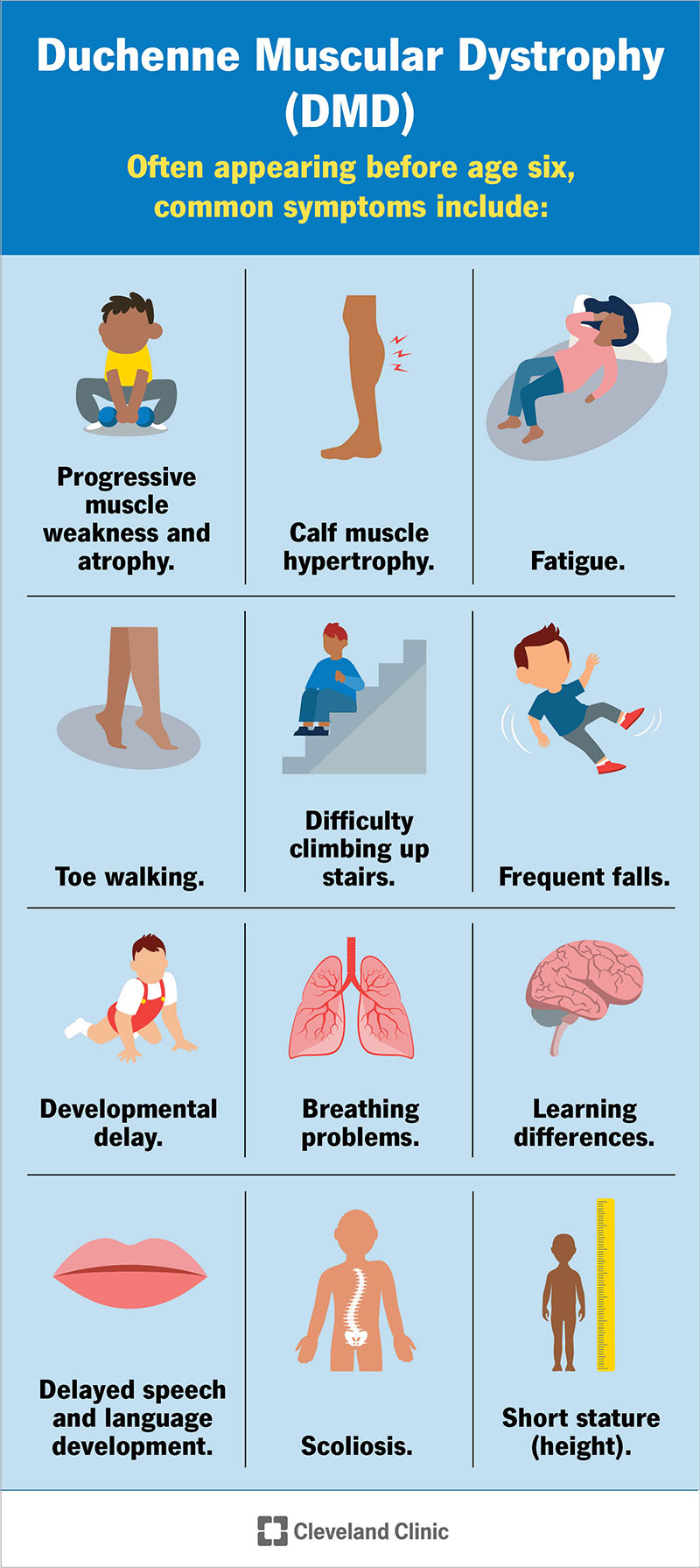 I sintomi della DMD compaiono spesso prima dei 6 anni e comprendono affaticamento, difficoltà a salire le scale, cadute frequenti, ritardo dello sviluppo e altro ancora.