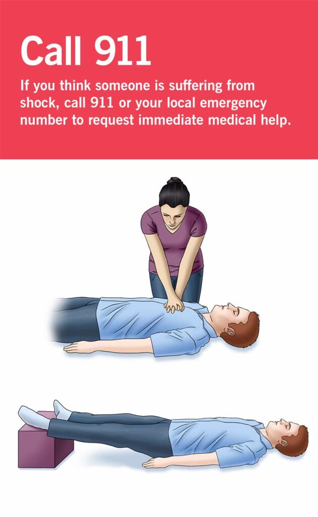 24055 shock first aid treatment