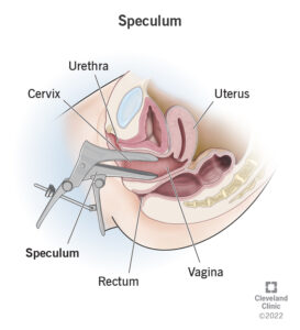 24238 speculum