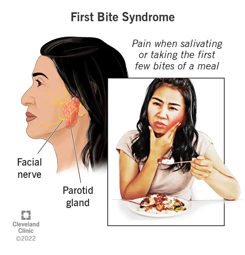 24603 first bite syndrome