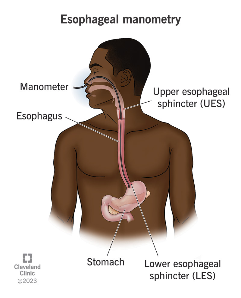 4952 esophageal manometry