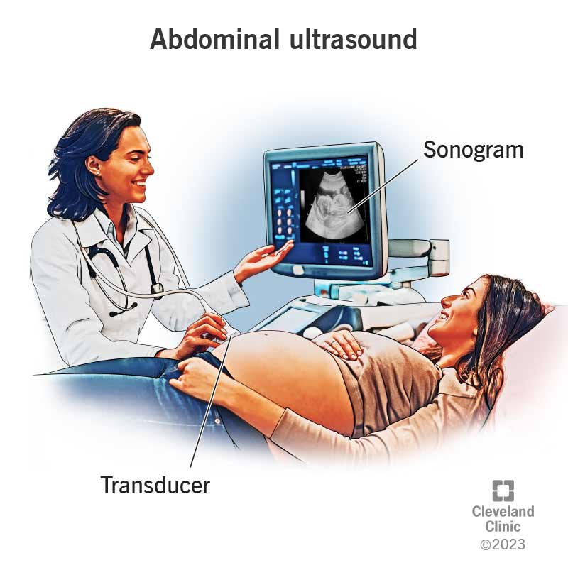 4994 abdominal ultrasound