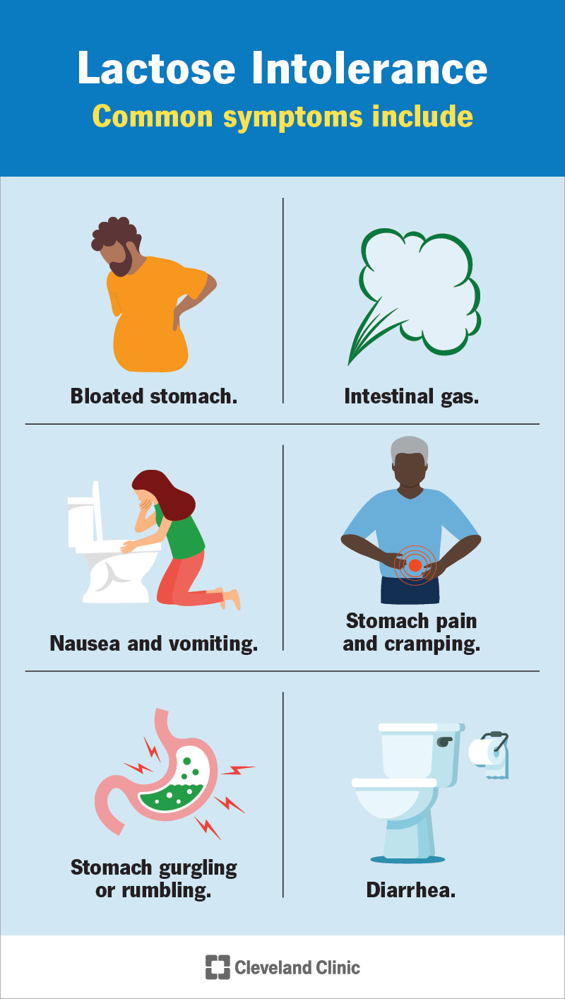 I sintomi comuni dell’intolleranza al lattosio includono gonfiore, gas e diarrea.