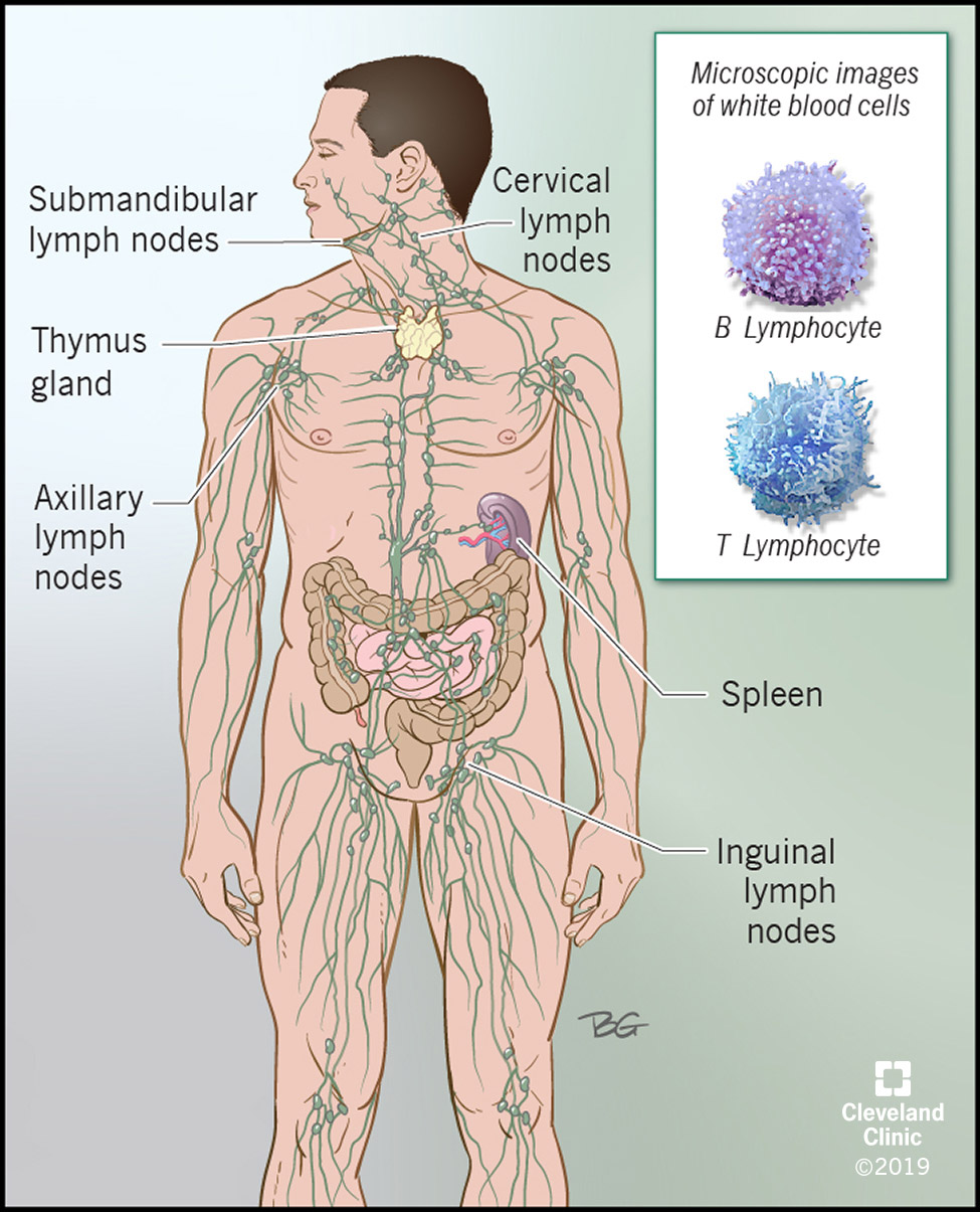 Il sistema linfatico corre in tutto il corpo, con nodi che possono essere colpiti dalla malattia di Castleman.