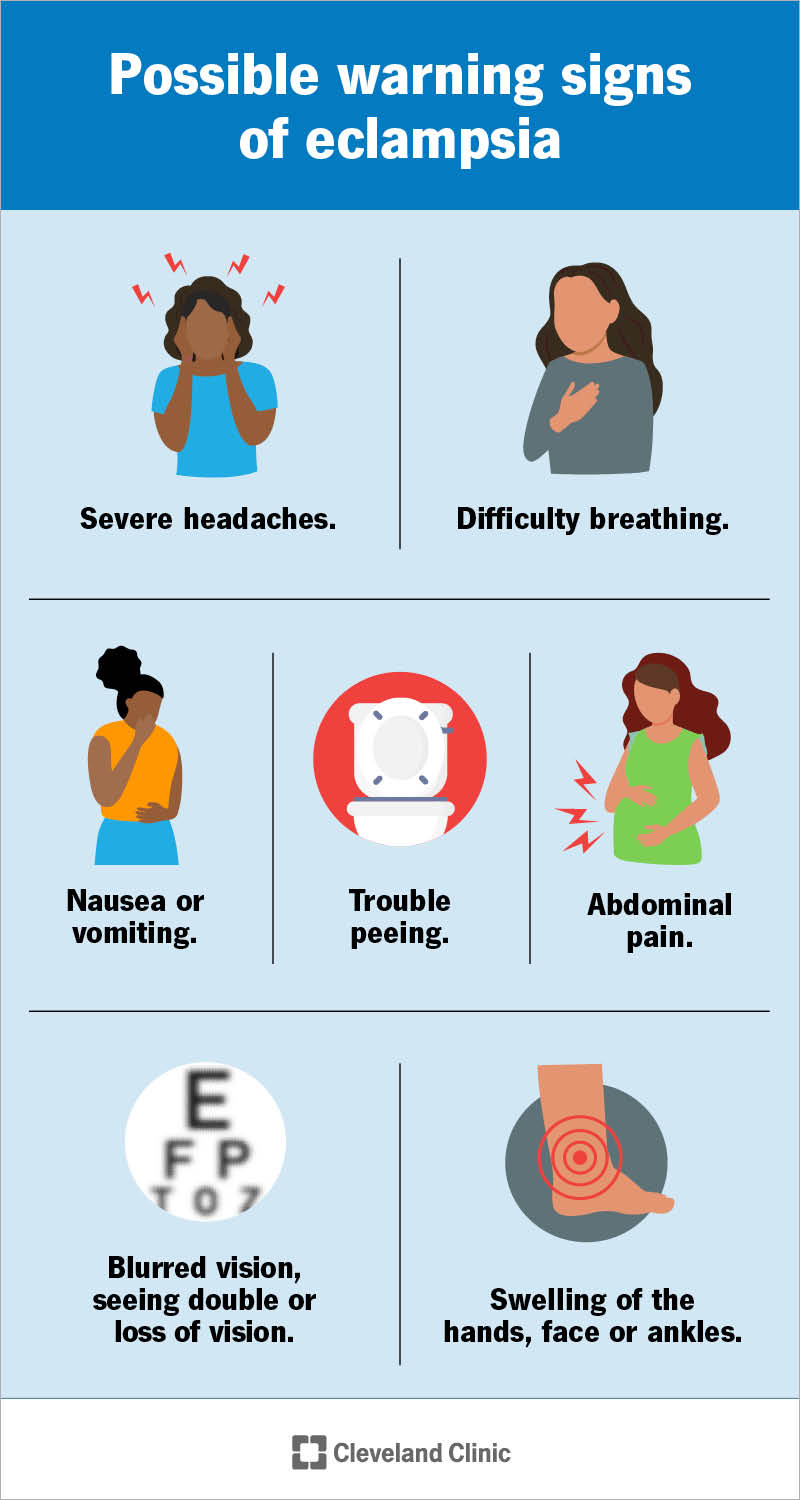 Segni premonitori di eclampsia