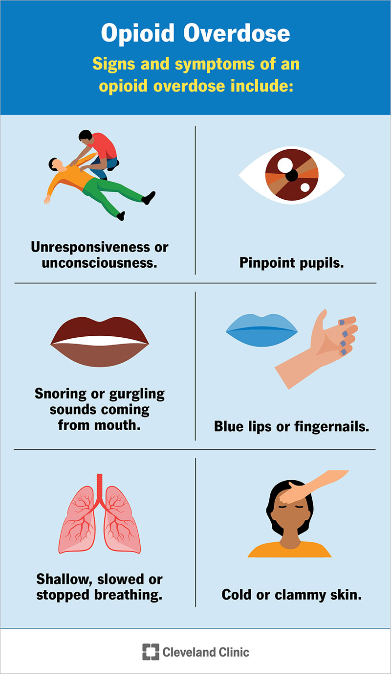 I sintomi di un’overdose da oppioidi includono perdita di coscienza, pupille puntiformi, labbra e unghie blu, respiro superficiale o interrotto e altro ancora.