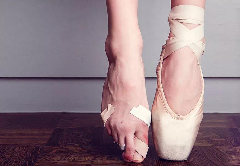 ballerina feet bruises bandaids 177683142 770x533 1 jpg