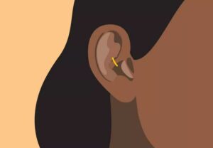 ear stapling1 1310664640 770x533 1 jpg