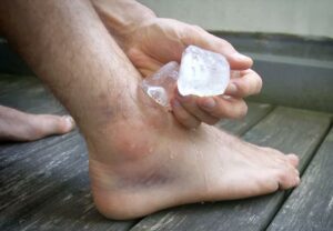 iceAnkle 1156749652 770x553 jpg