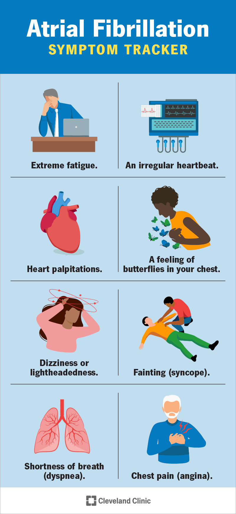 Un ECG appare diverso per chi ha la fibrillazione atriale. Ci sono piccole onde irregolari tra i battiti cardiaci.