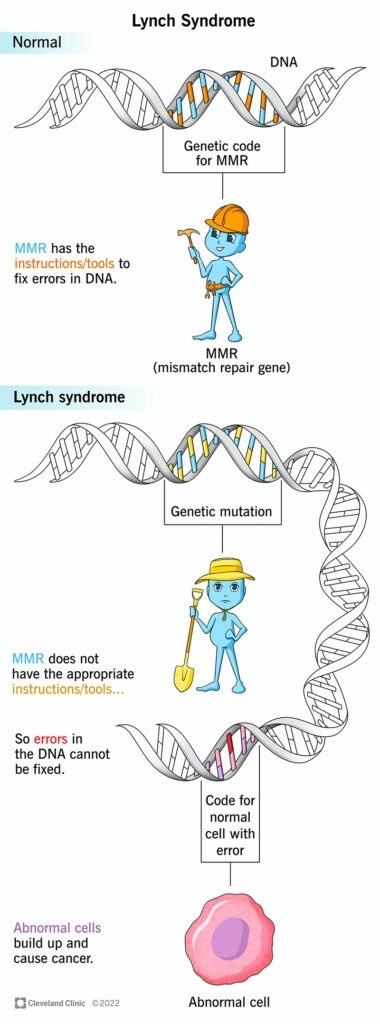 17195 lynch syndrome