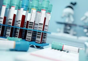 bloodTestSamples 1300036844 770x533 1 jpg