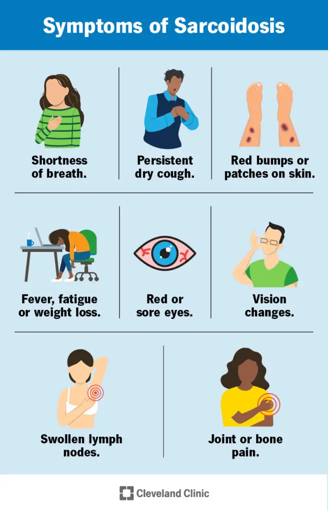 11863 sarcoidosis