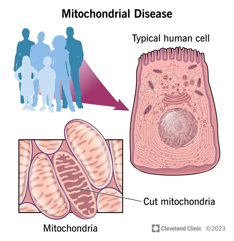 15612 mitochondrial disease