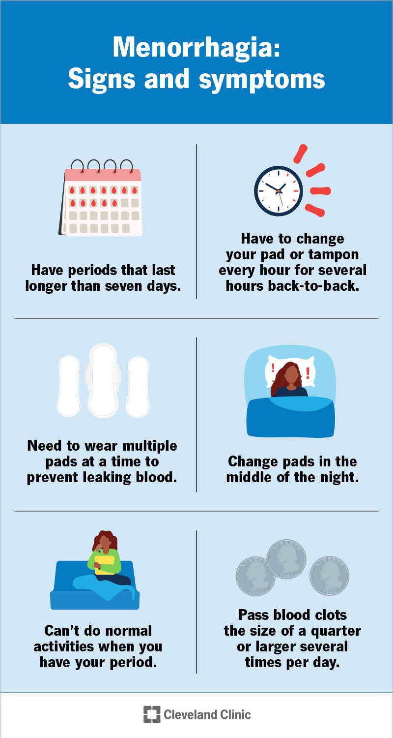 Alcuni segnali della menorragia sono l'uso di più assorbenti contemporaneamente e il ciclo mestruale che dura sette giorni o più.