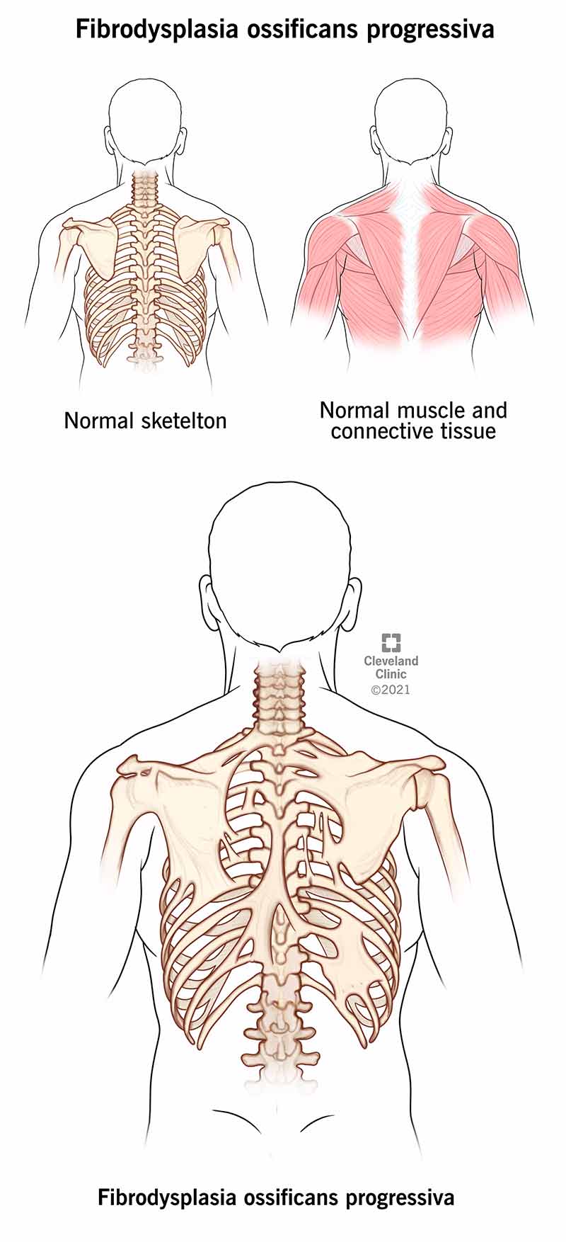 I muscoli e il tessuto connettivo del tuo corpo si trasformano in ossa che ricoprono la parte esterna dello scheletro.