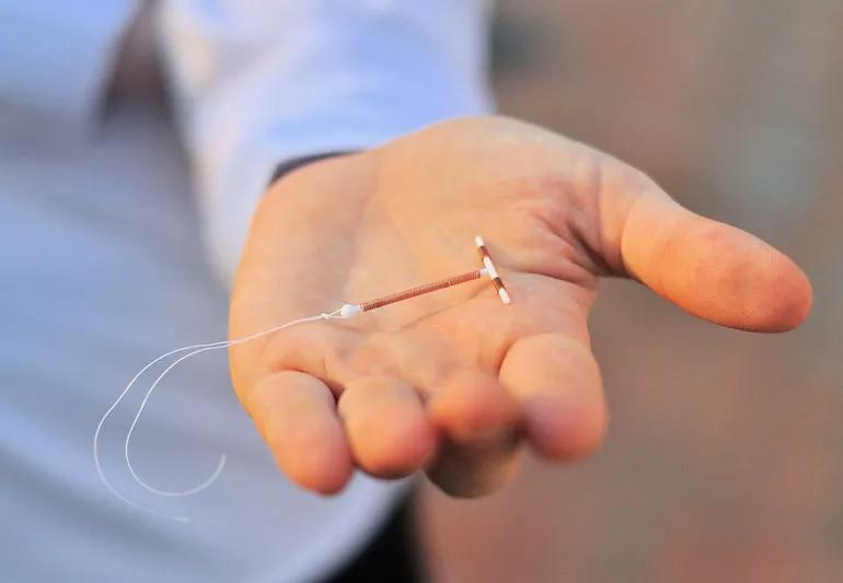 IUD 478967467 770x553 1 jpg