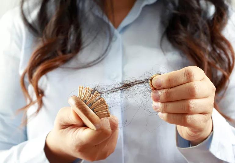 lowIronHairLoss 1325263595 770x533 1 jpg