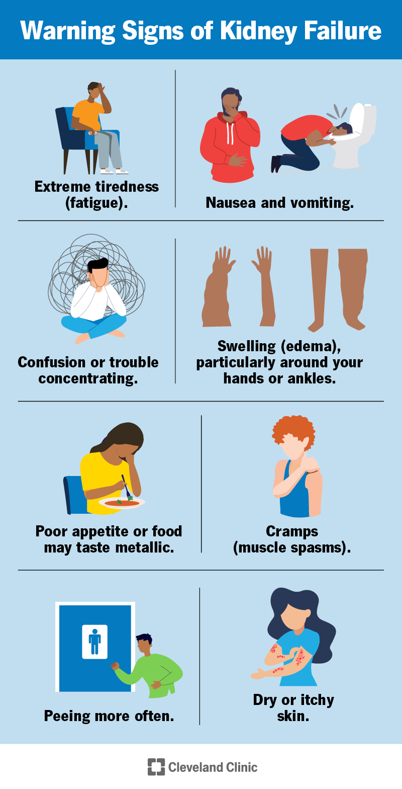 Le persone con insufficienza renale possono sentirsi male e confuse. Possono anche avere gonfiore, crampi, affaticamento e possono urinare più spesso.