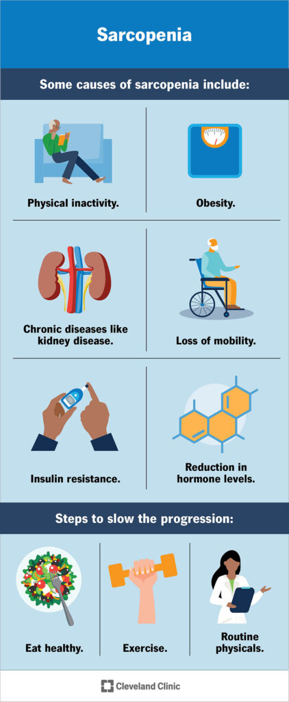 23167 sarcopenia infographic