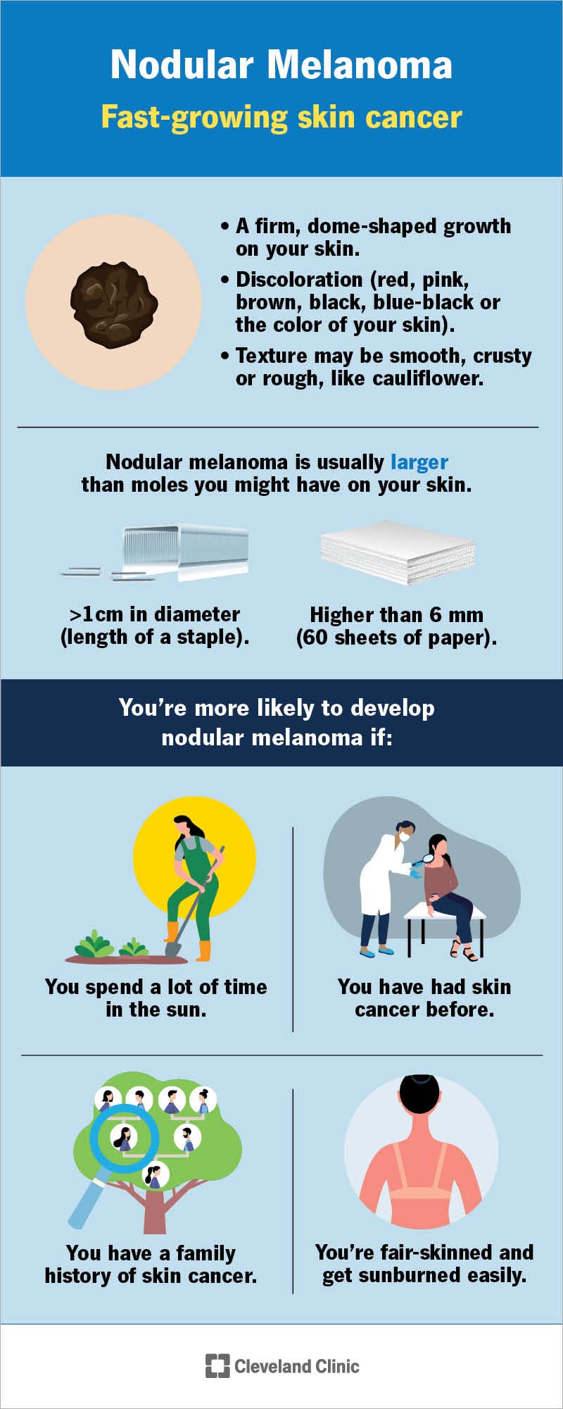 Un grafico che descrive le caratteristiche del melanoma nodulare e i soggetti più predisposti a svilupparlo.